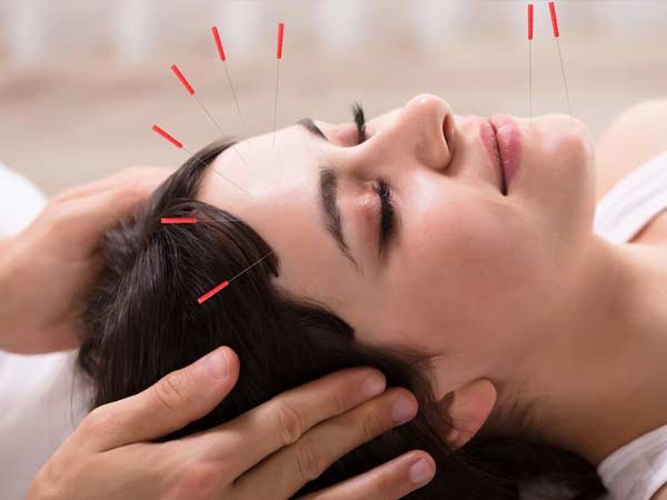 Facial Acupuncture facial-acupucture